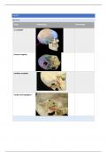 Anatomie 4, dissecties: samenvatting hoofd