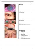 Overzicht aandoeningen oog (met afbeeldingen!)