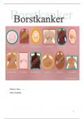 Case uitwerking Borstkanker.