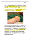 NUR 650 Swollen and Painful Knee Case Study 2023/24