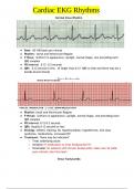 Cardiac EKG Rhythms (Updated) Normal Sinus Rhythm
