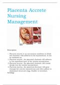 Placenta Accrete Nursing Management.