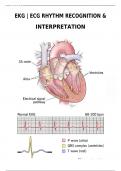 EKG | ECG RHYTHM RECOGNITION & INTERPRETATION