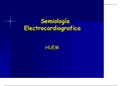 Semiología EKG 