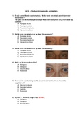 Oefenvragen (30) Optometrie Jaar 1 Oogheelkunde Blok C