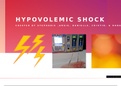 NURSING NR 324 HYPOVELOMIC SHOCK Week 1 Adult Health Group Presentation Edited