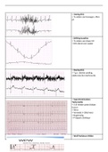 Visualisatie Interpretatie ECG