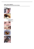 Optometrie Leerjaar 1, Blok C - HC3 Oogheelkunde Normaal abnormale bevindingen