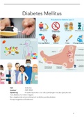 Diabetes Mellitus (voeten) belangrijkste  informatie 