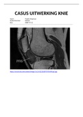 MRI casus uitwerking van de KNIE P7