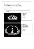 Radiologie semester 2A thorax en AEC